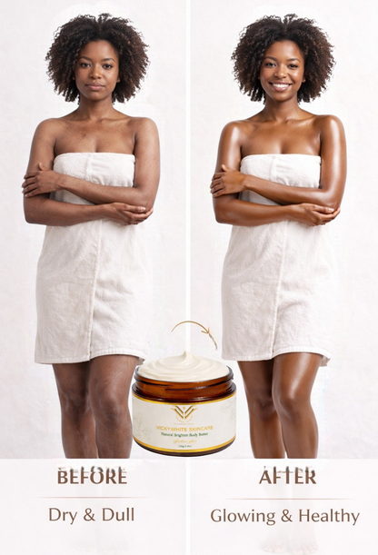 Natural Brightening  Body Butter-Niacinamide, HyaluronicAcid, KojicAcid,  Collagenpeptide(250g)
