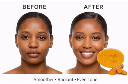 Turmeric Kojic Glow Soap 100g (2-packs)