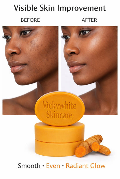 Turmeric Kojic Glow Soap 100g (2-packs)