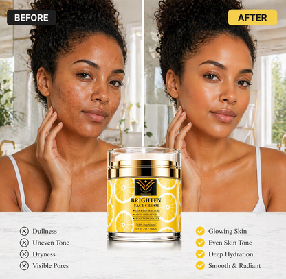 Vitamin C Face Cream with Niacinamide & Kojic Acid – Brightening Moisturizer for Dark Spots, Uneven Skin Tone & Fine Lines | Hydrating Anti-Aging Cream for Radiant Glow | VickyWhiteSkincare